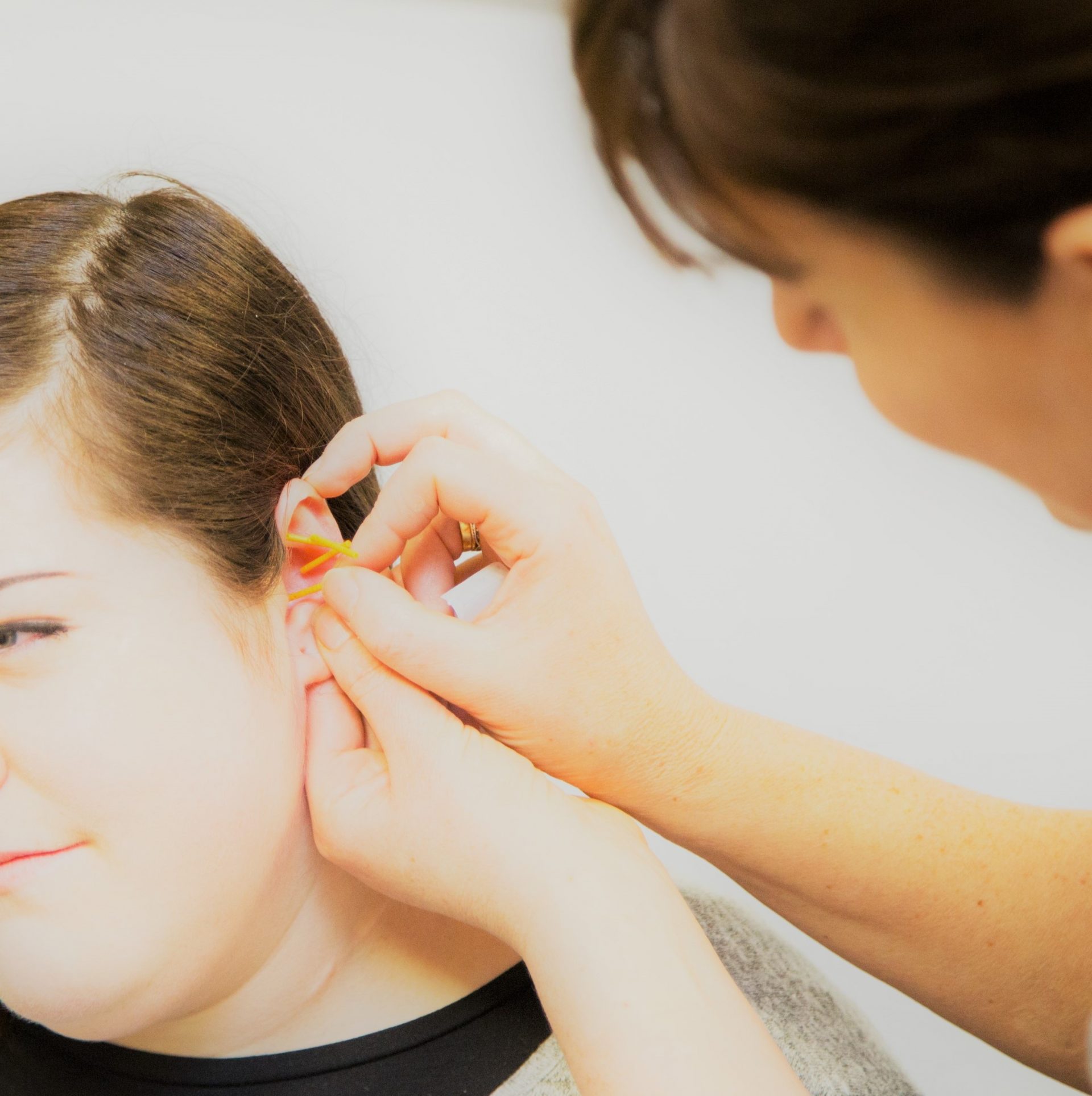 Auricular Acupuncture at Broadway Lodge